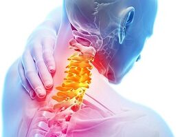 Main signs and symptoms of cervical osteochondrose