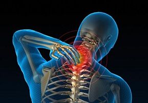 Why develops and how the manifestation of cervical osteochondronje
